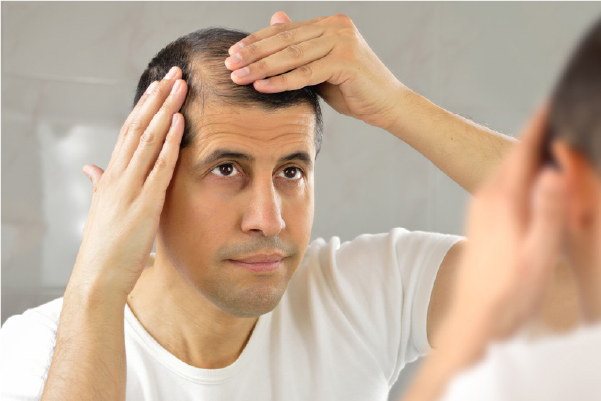 Understanding hair loss causes and natural treatments